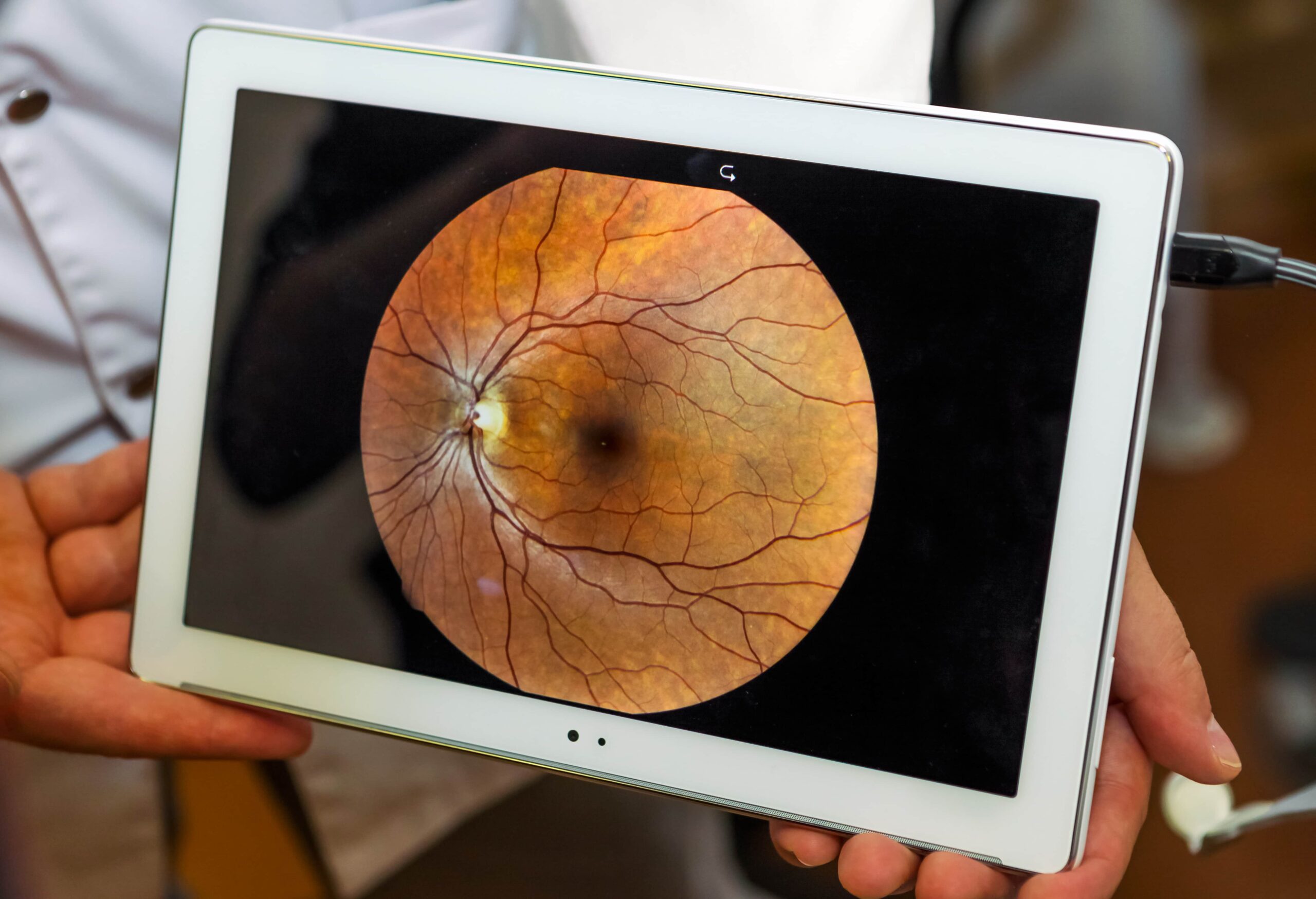 Eye Health Evaluation Services in Florida | Call (561) 429-8753